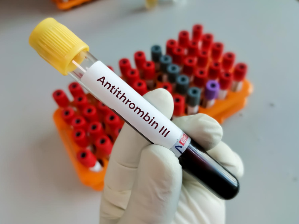 ANTITROMBINA III BAXALTA